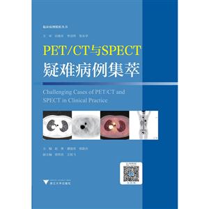 PET/CTSPECTѲ