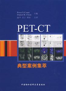 PET-CTͰ