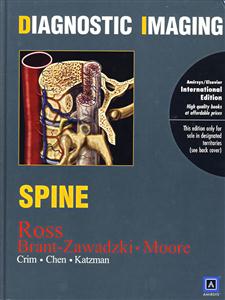 SPINE